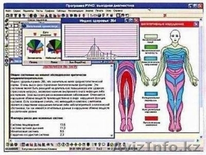 Компьютерная диагностика всего организма 