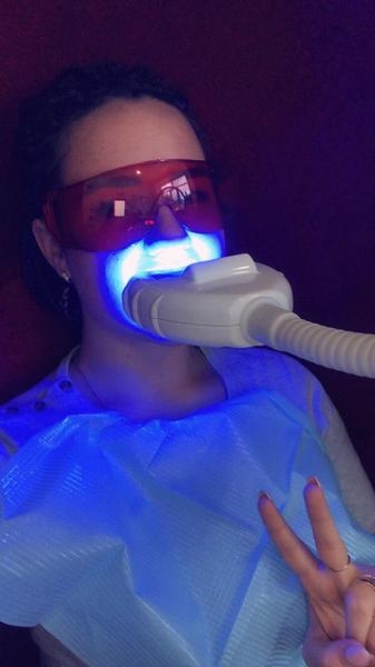 Косметическое отбеливание зубов Караганда - Изображение #4, Объявление #1668792